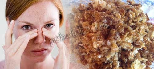 Женщина болеющая синуситом Синусит