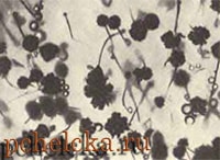 Возбудитель аспиргиллёза - гриб Aspergillus flavus