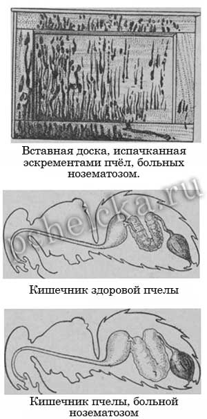 Проявление нозематоза